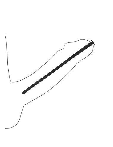 Lot de 4 Tiges pour Urètre Sporal Screw 30cm - Diamètres de 7 à 10mm