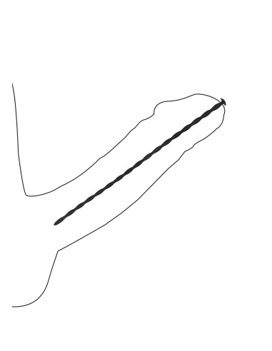 Pack de 4 tiges pour urètre Spiral Screw 30 cm - Diamètres de 3 à 6mm